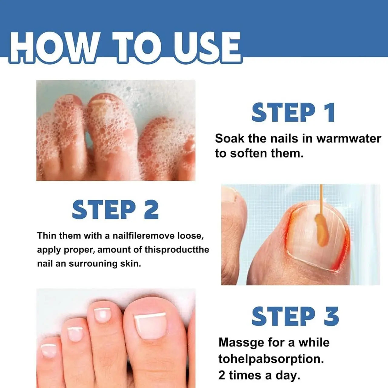 Nail Fungus Repair Cream – 100gm