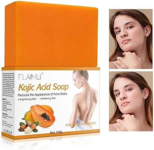 Kojic Acid Brightening Soap – 200g