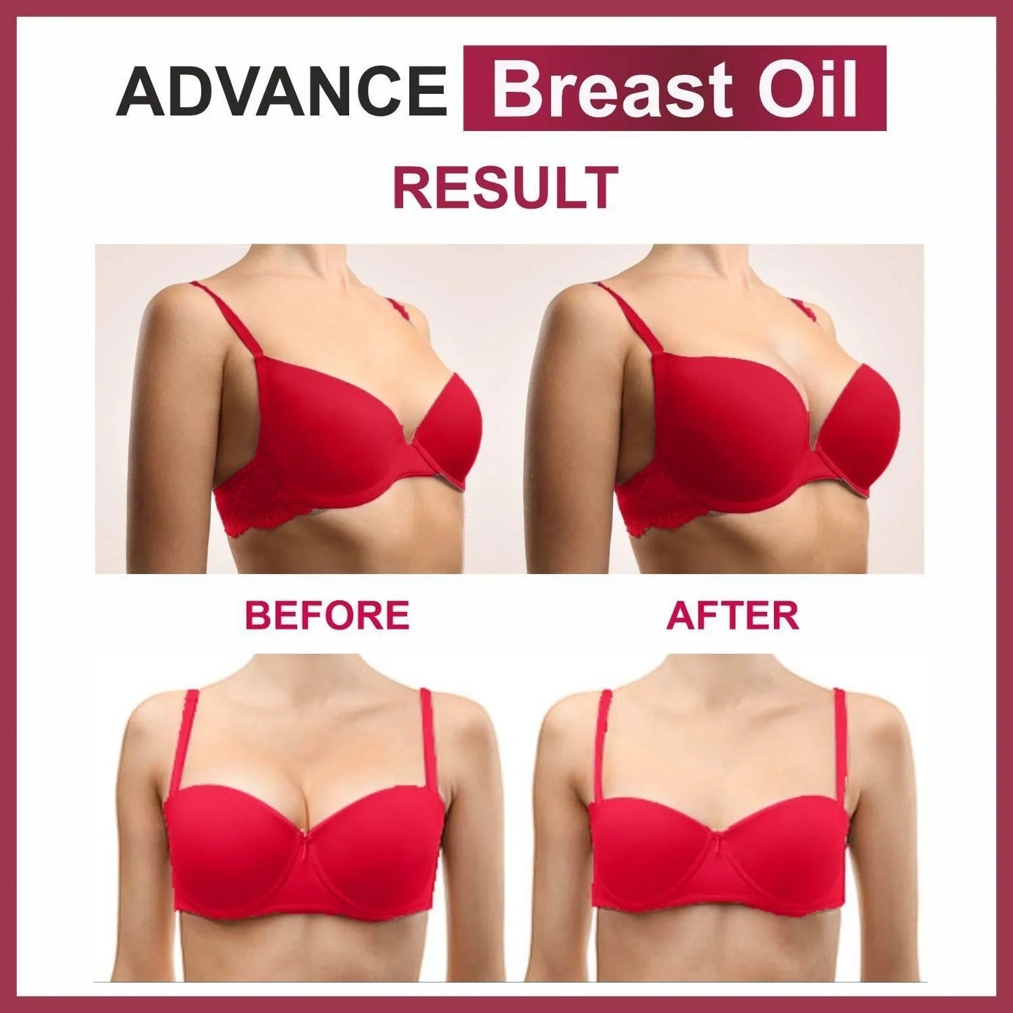 Oilanic B 36 Breast Oil – 30ml
