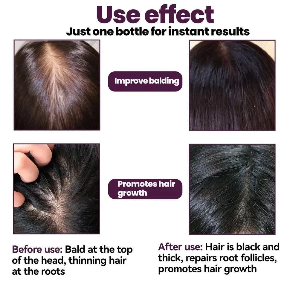 Hair Growth Foam Shampoo – 60ml