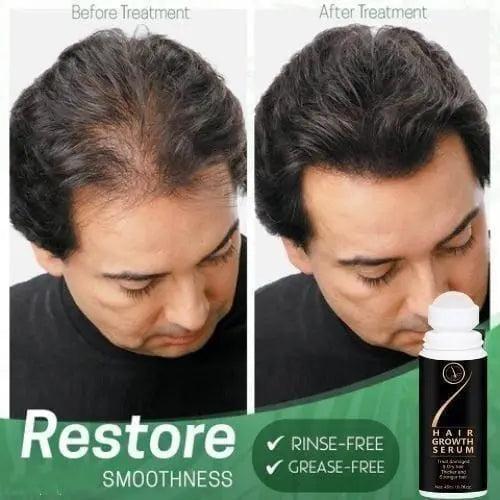 Hair Growth Serum – 45ml