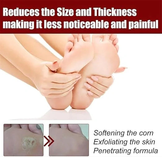 Feet Corn Removal Serum 30ml