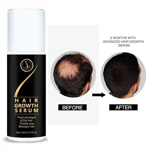 Hair Growth Serum – 45ml