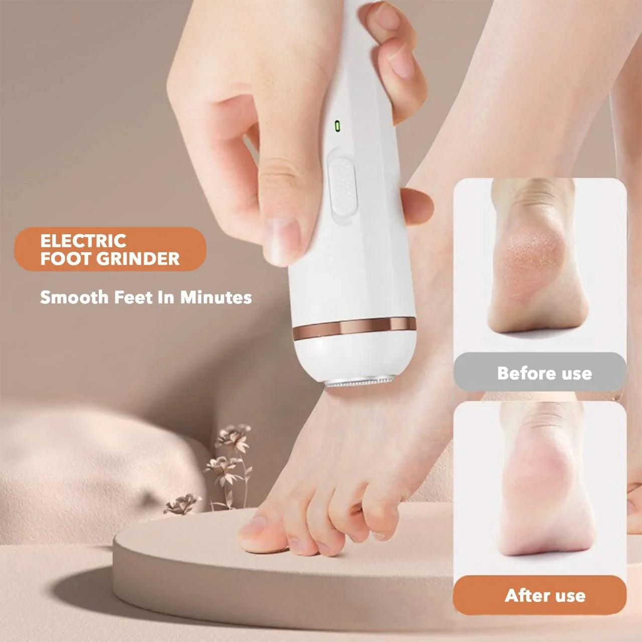 Wireless Foot Callus Remover