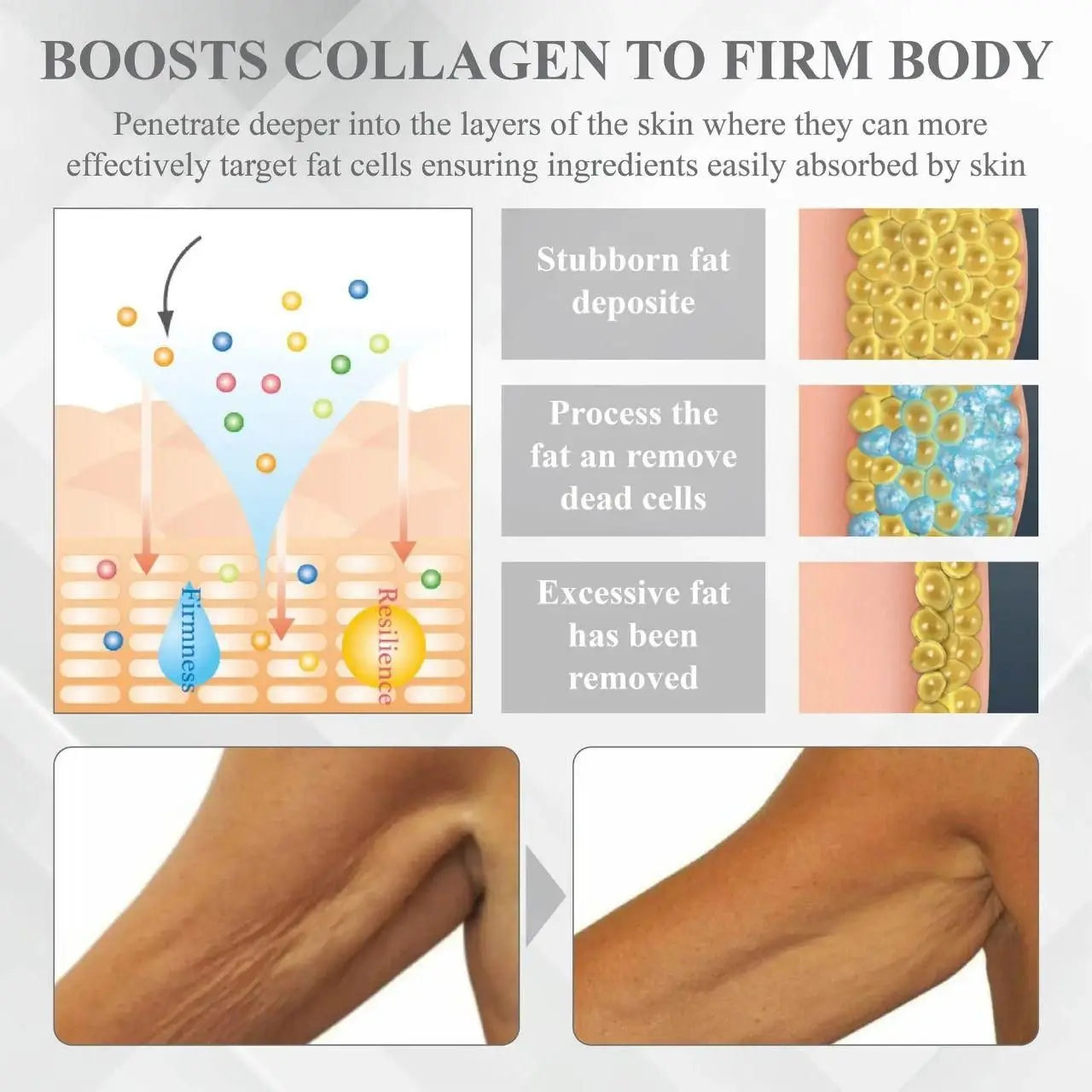 PisaRedm Venom Detox Cream – 200gm (Pack of 2)