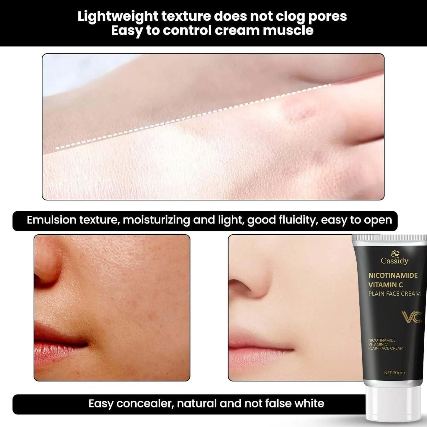 CASSIDY Nicotinamide Vitamin C Cream