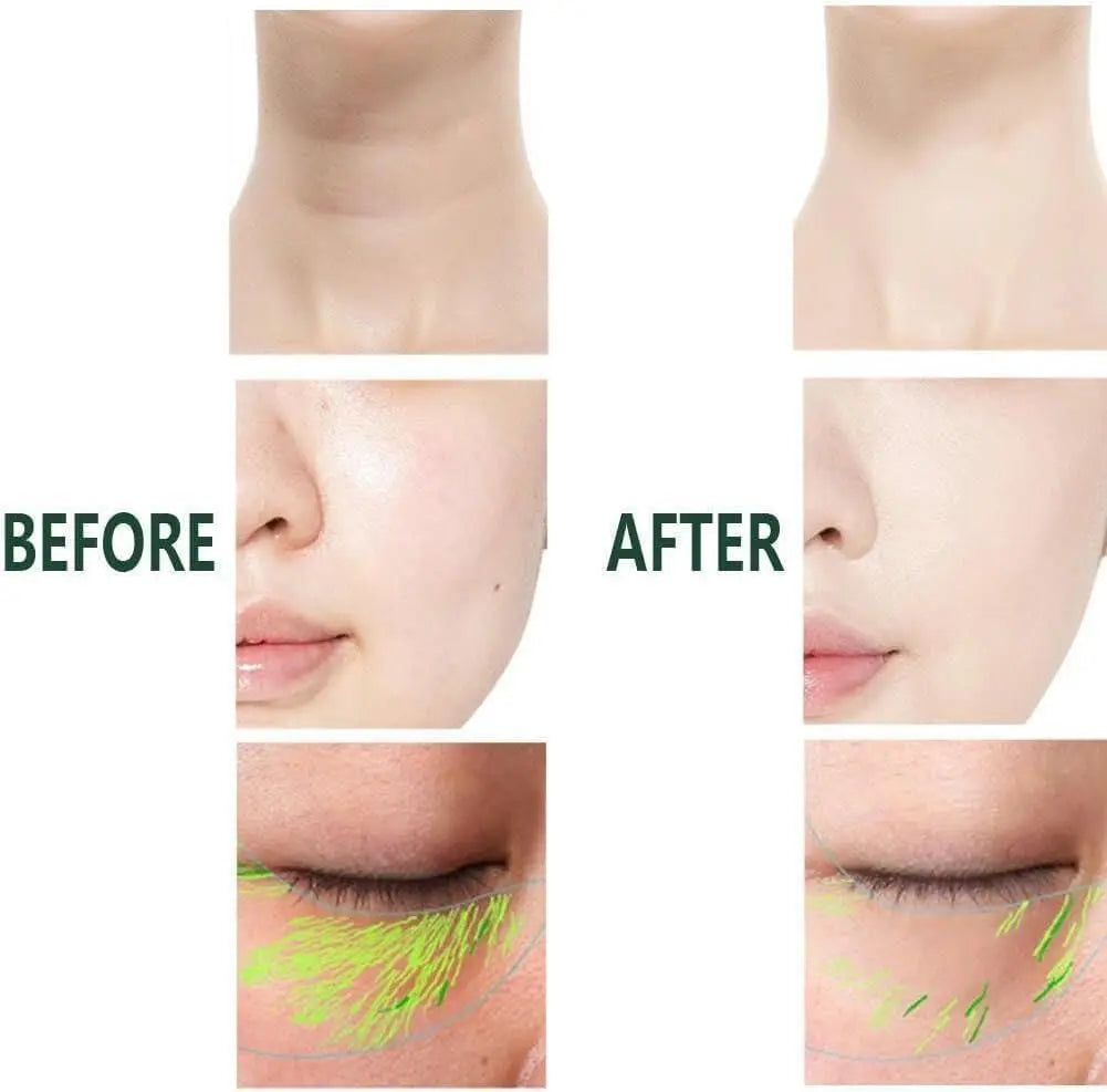 2 In 1 Anti-Wrinkle Facial Massager