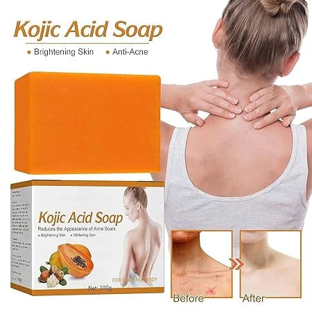 Kojic Acid Brightening Soap – 200g