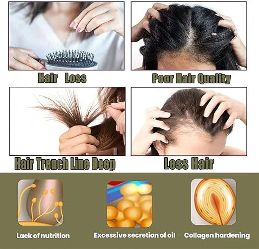 Hair Growth Foam Shampoo – 60ml