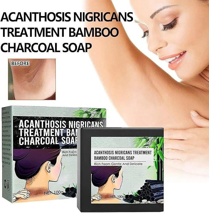 Acanthosis Nigricans Charcoal Soap