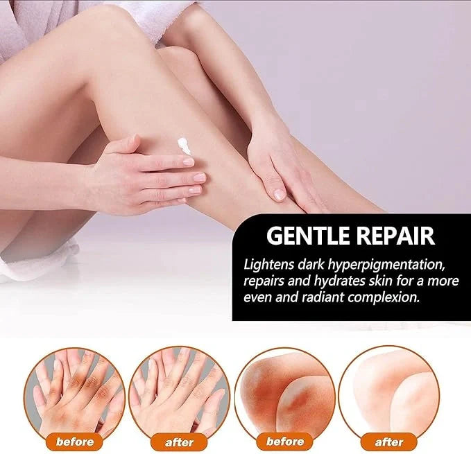 Acanthosis Nigricans Charcoal Soap