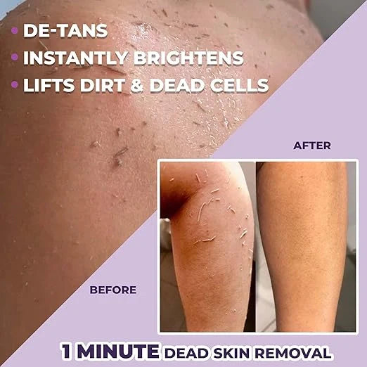 Dead Skin & Tan Remover Combo