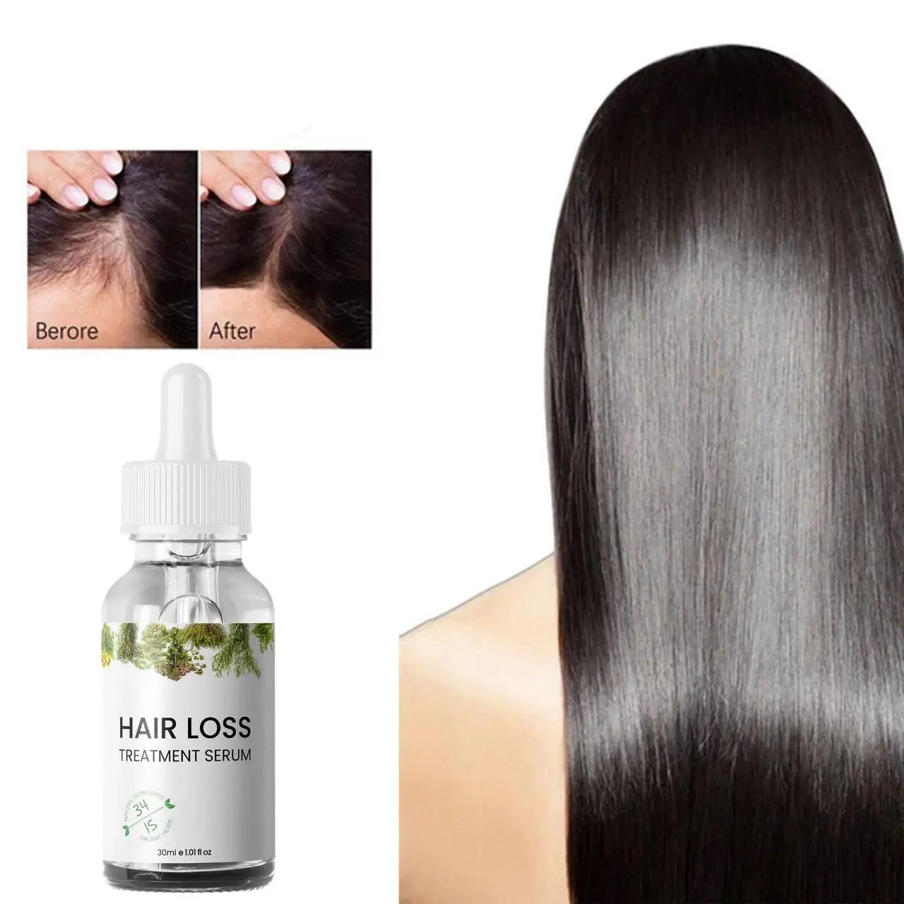 Hair Loss Treatment Serum – 30ml