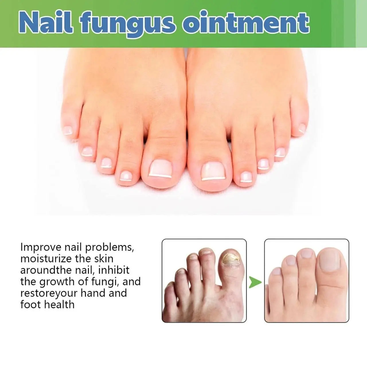 Nail Fungus Repair Cream – 100gm