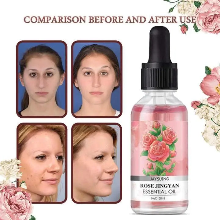 Rose Jingyan Essential Oil – Pack of 2