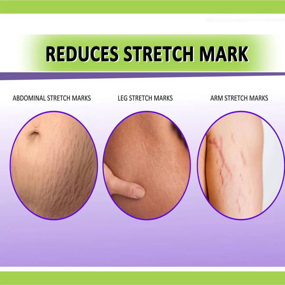 Panchvati Herbal Stretch Mark Gel