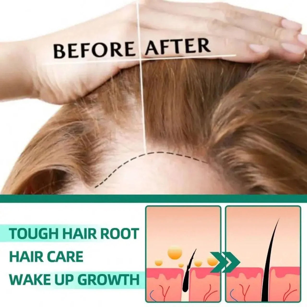 Wets & Months Hair Growth – 60ml