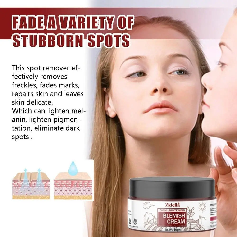 Zidella Blemish Cream 50g