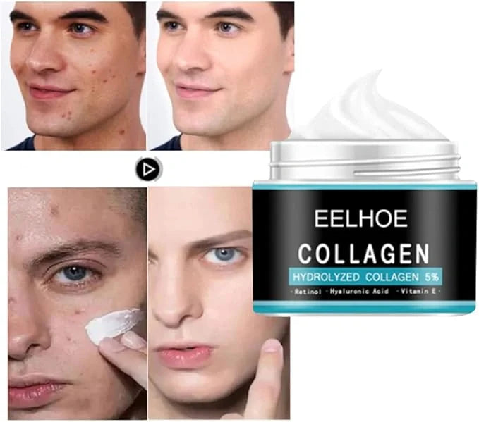 Eelhoe Hydrolyzed Collagen Cream (Pack of 2)