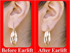 Pain-Free Earring Support Patches (100 Pieces)