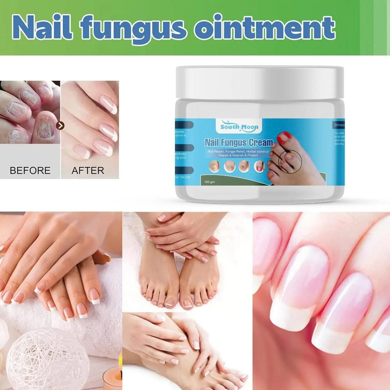 Nail Fungus Repair Cream – 100gm