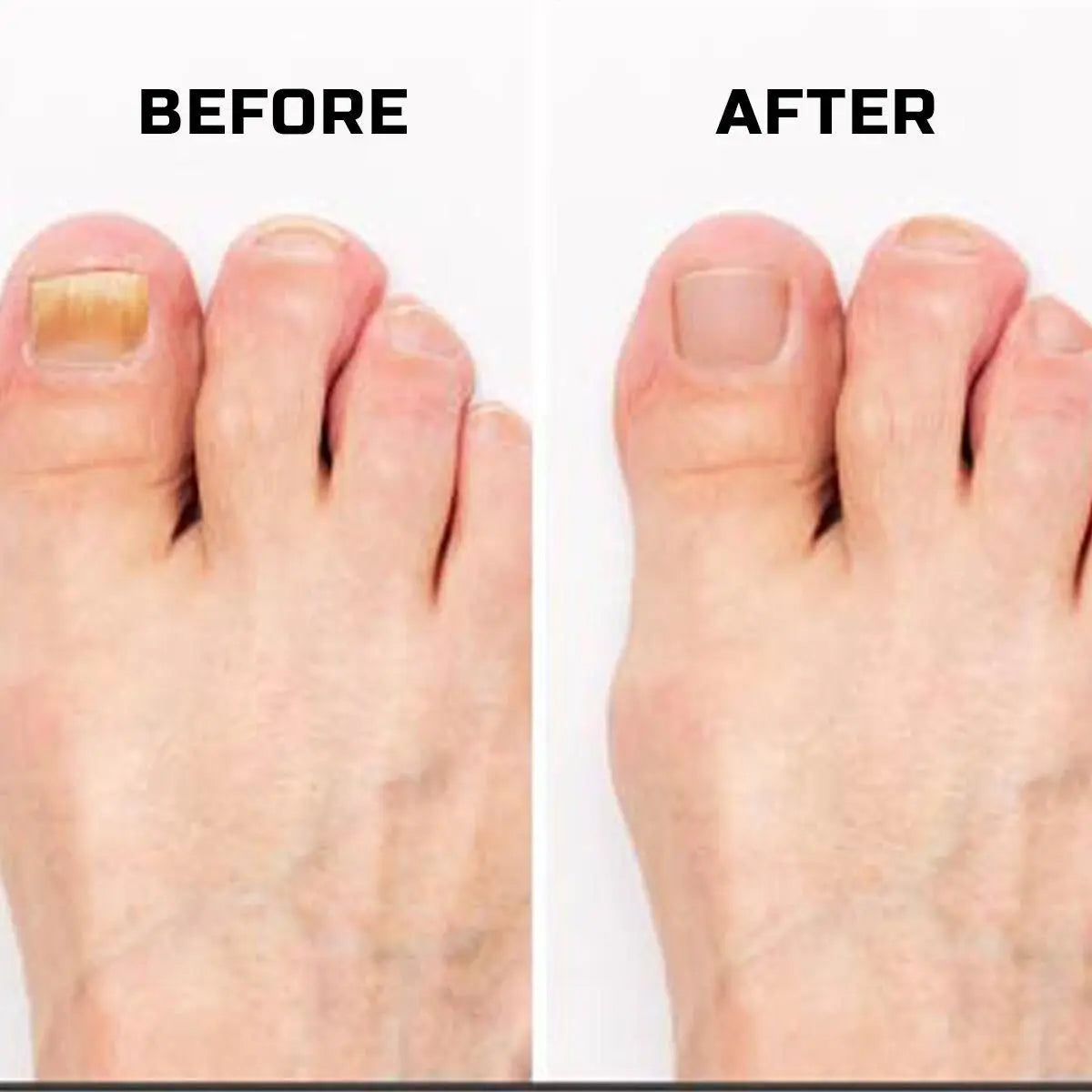 Nail Strength & Growth Oil