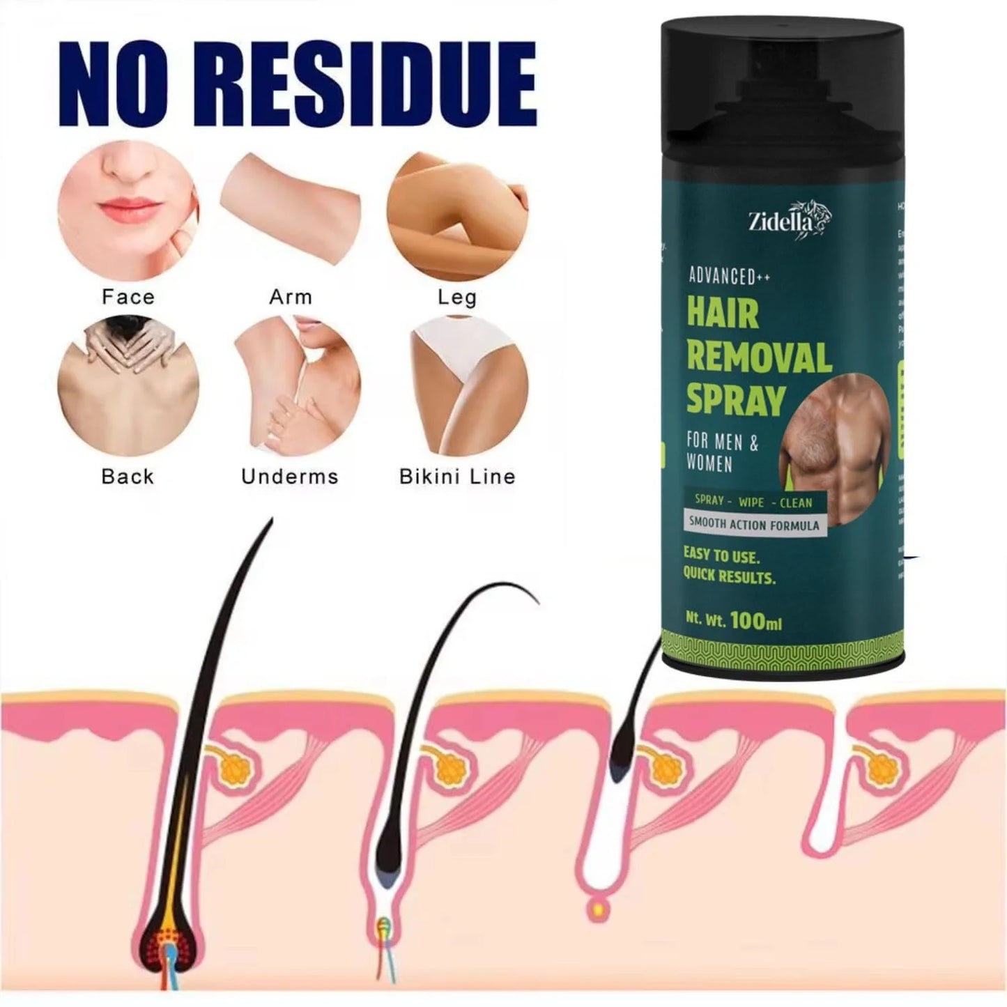 Zidella Hair Removal Spray 100ml