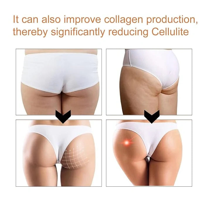 Ginger Butt Lifting Soap – Pack of 3