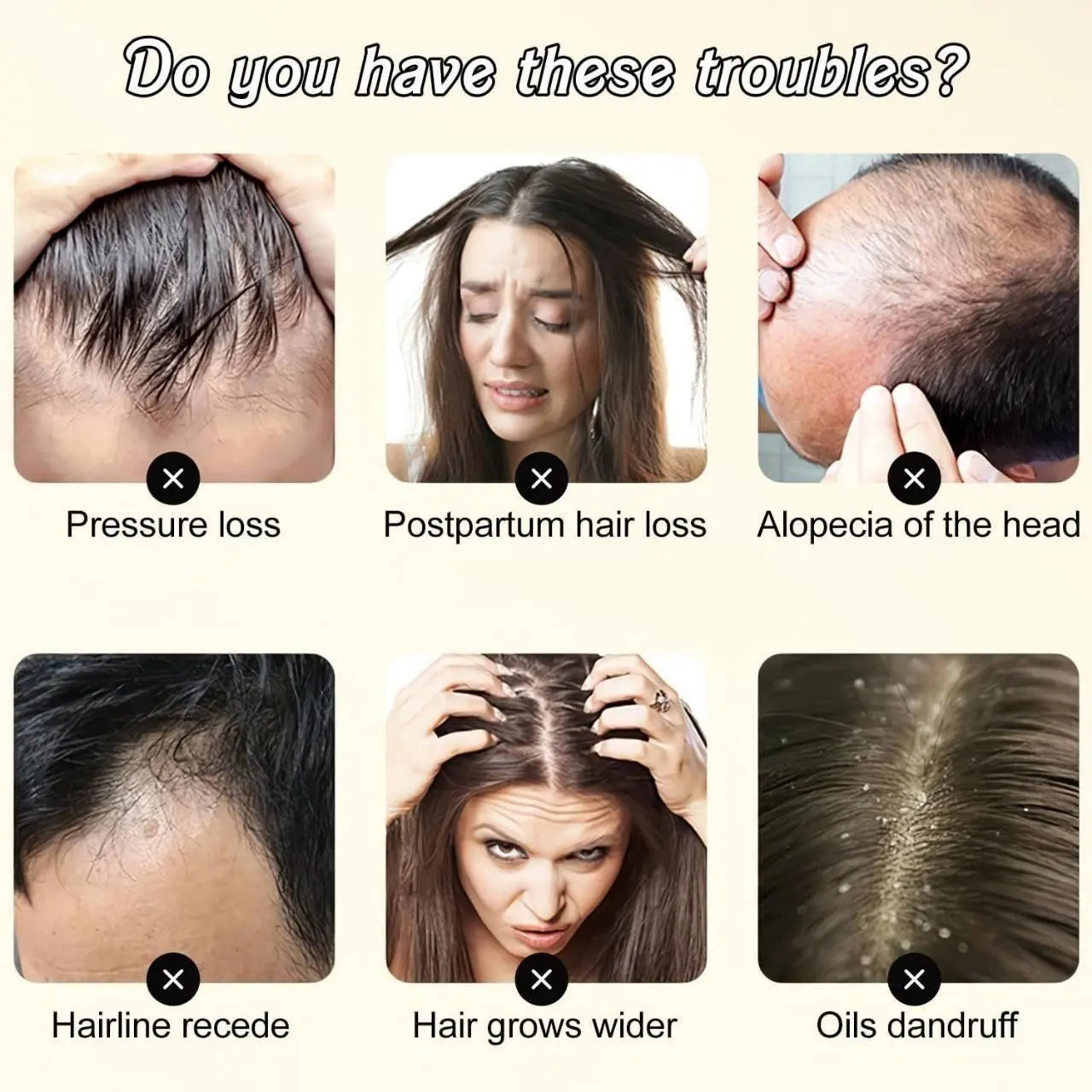 Multiflorum Anti-Hair Loss Shampoo