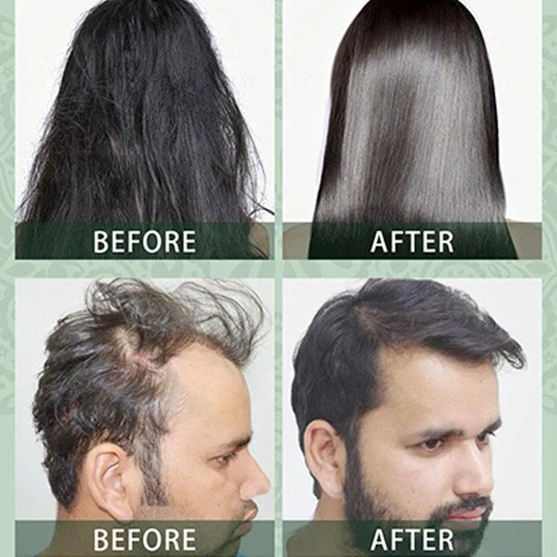 SH Adivasi Hair Oil – 60ml