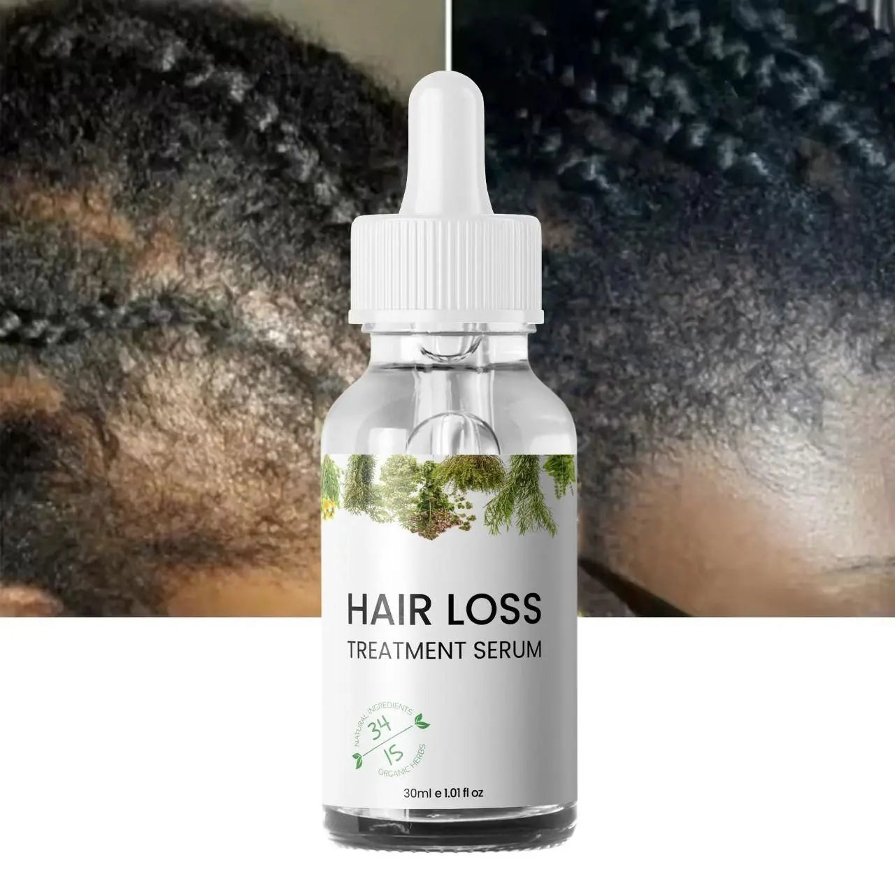 Hair Loss Treatment Serum – 30ml