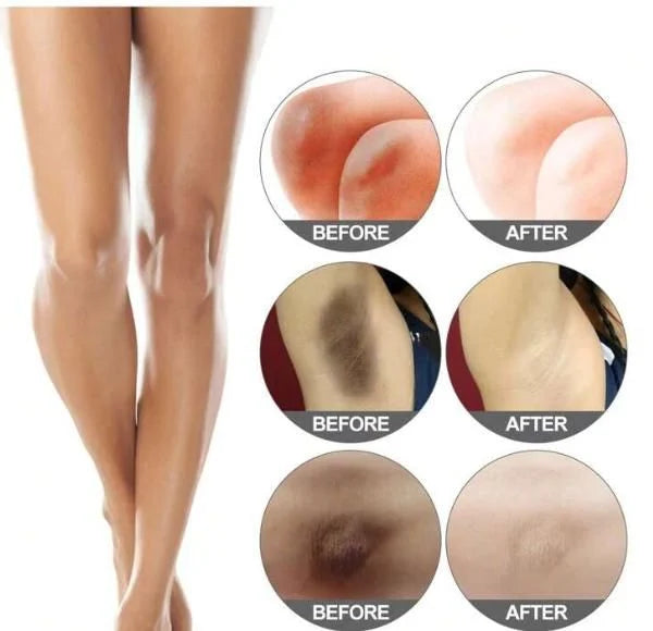 Skin Brightening Body Cream – Pack of 2