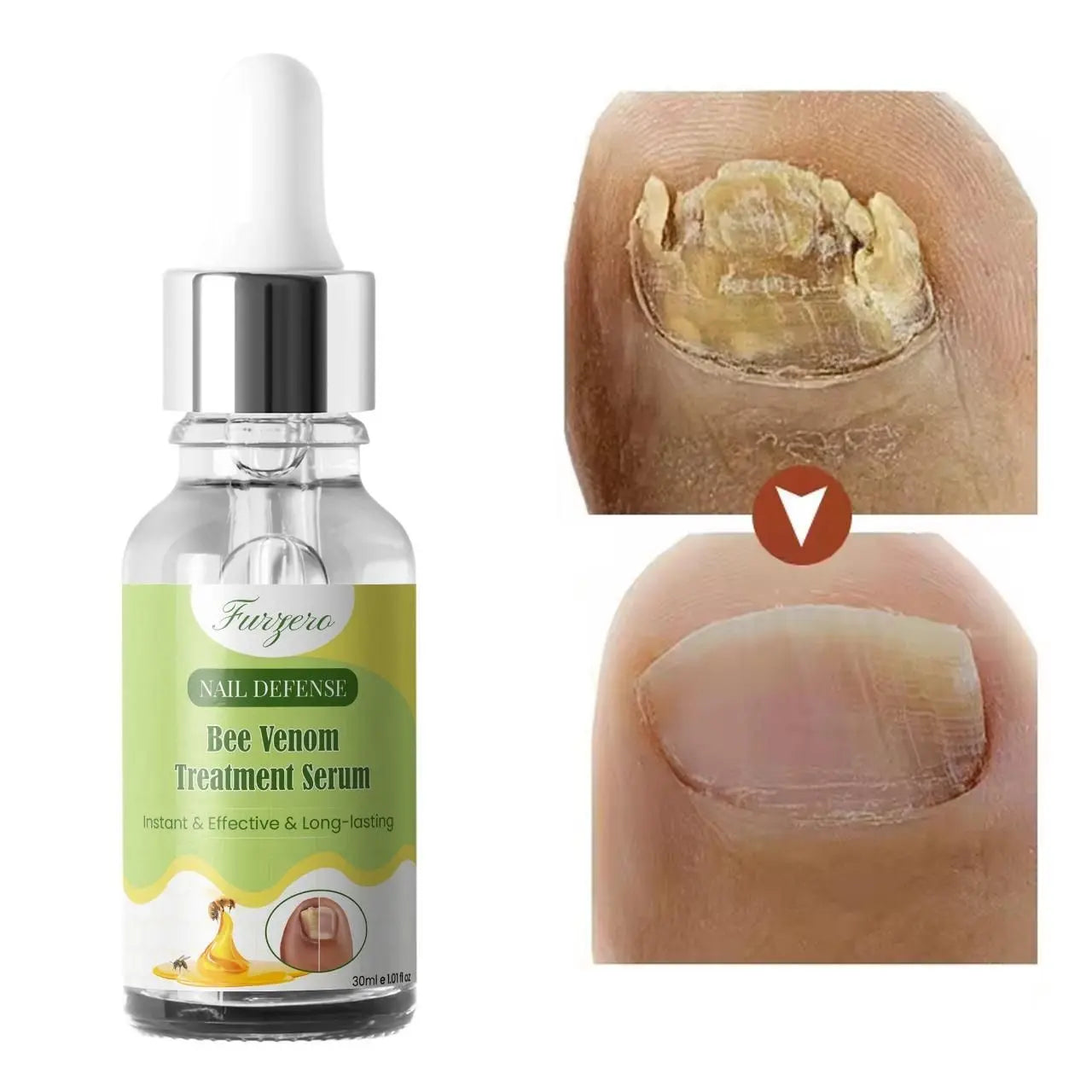 Furgero Bee Venom Nail Treatment Serum
