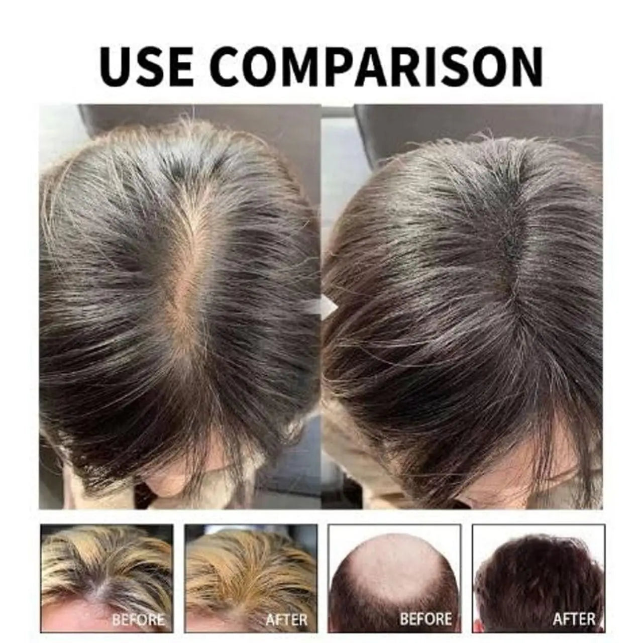 Hair Loss Treatment Serum – 30ml