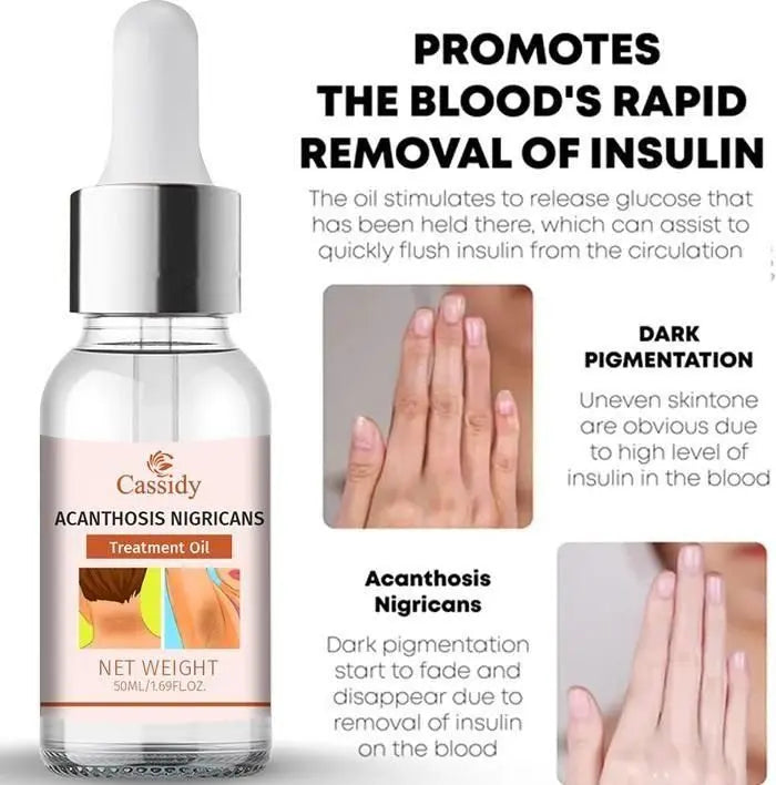 CASSIDY Acanthosis Nigricans Oil