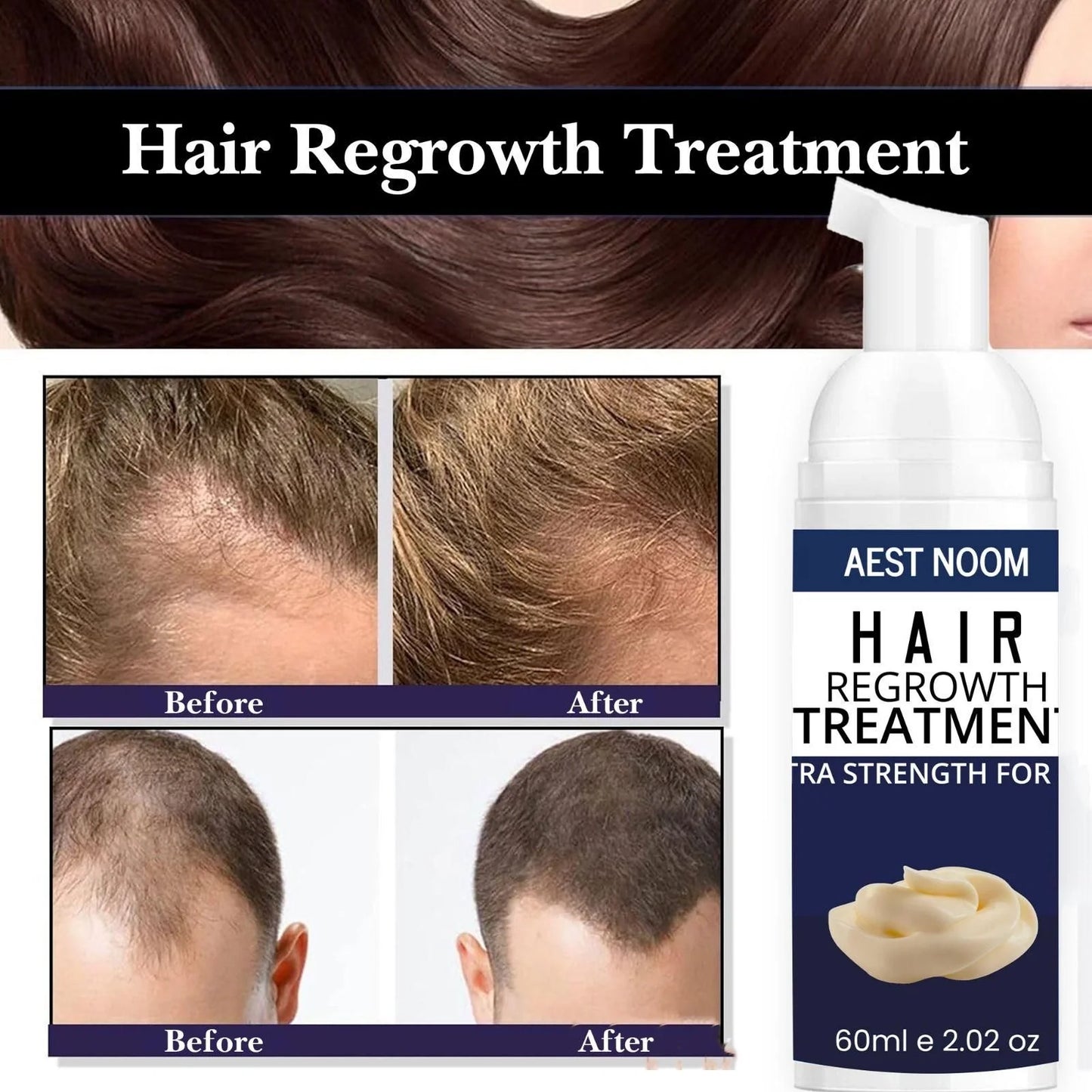 AEST NOOM Hair Regrowth – 60ml