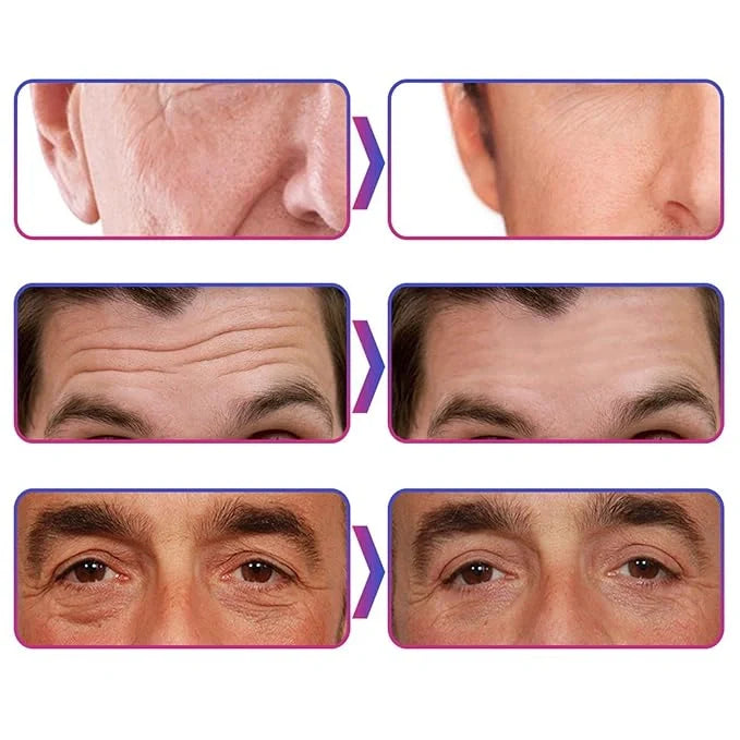 Eelhoe Hydrolyzed Collagen Cream (Pack of 2)