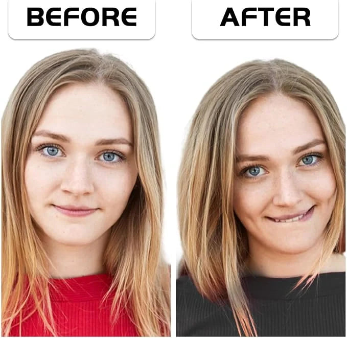 Dimples Smile Exerciser Tool