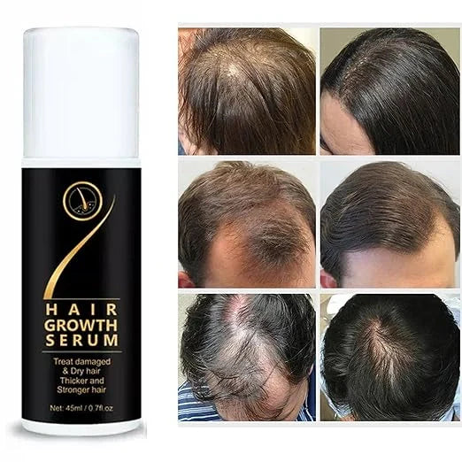 Hair Growth Serum – 45ml