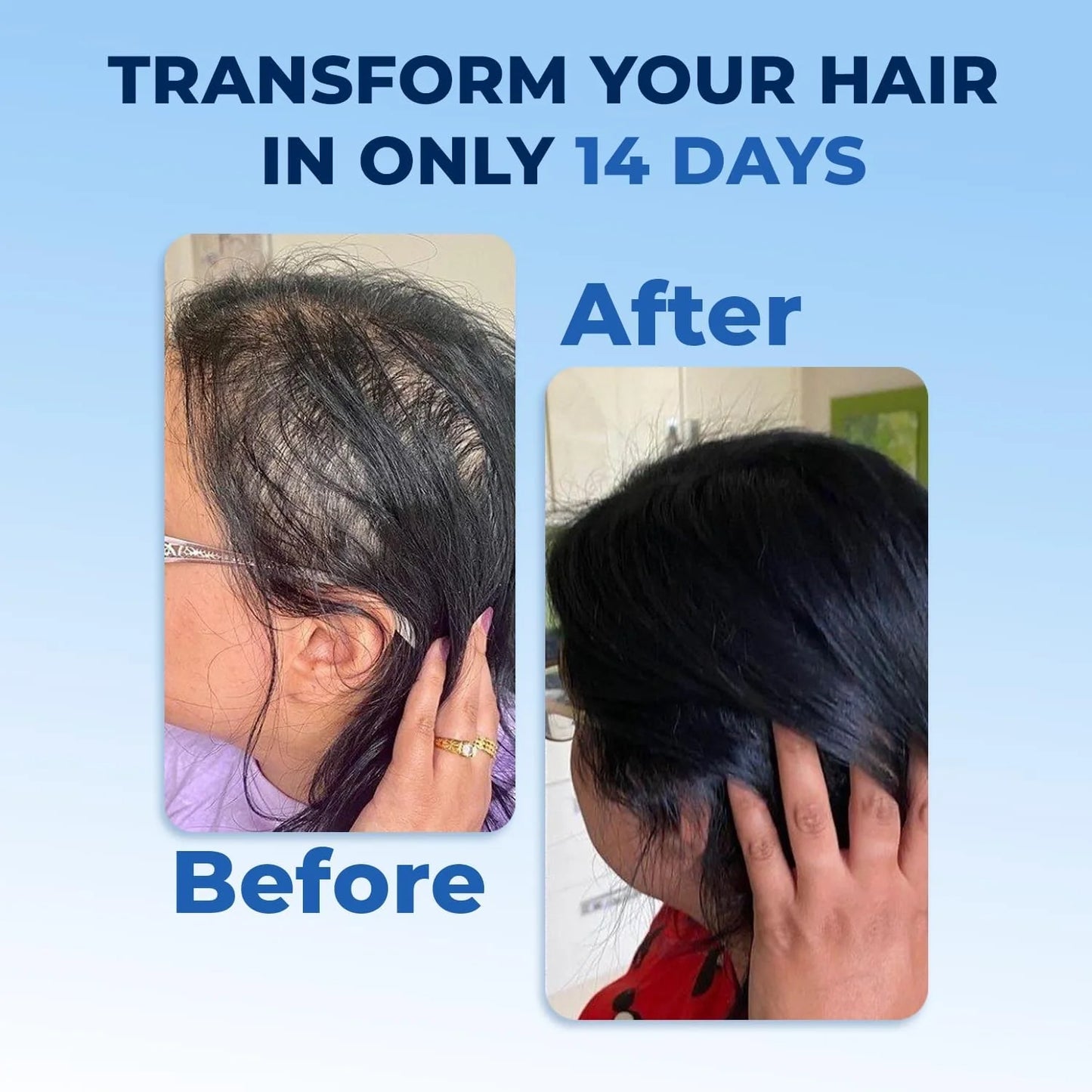 EFGPLUS Hair Growth Spray – 50ml (Pack of 2)