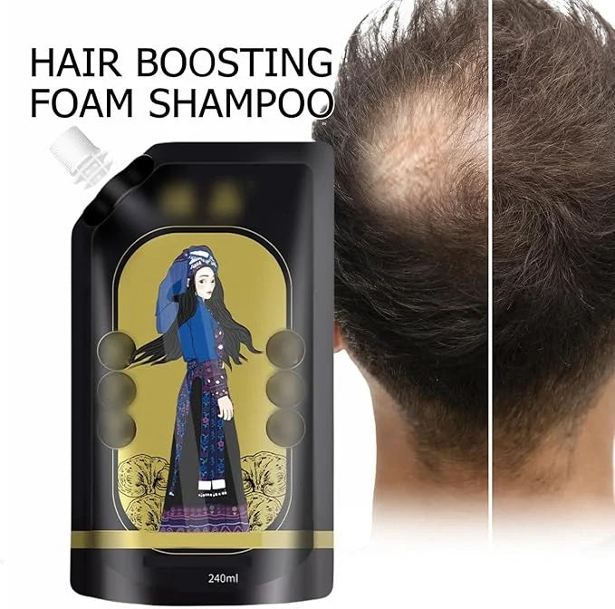 Multiflorum Anti-Hair Loss Shampoo