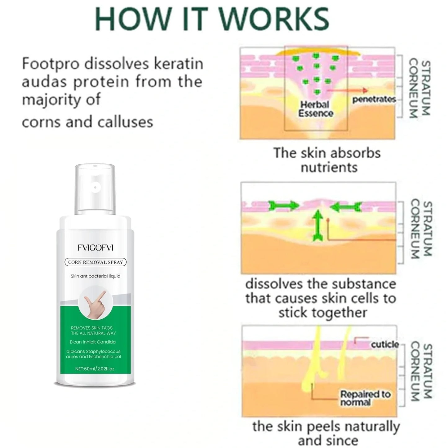 Fvigofvi Corn Removal Spray – 60ml