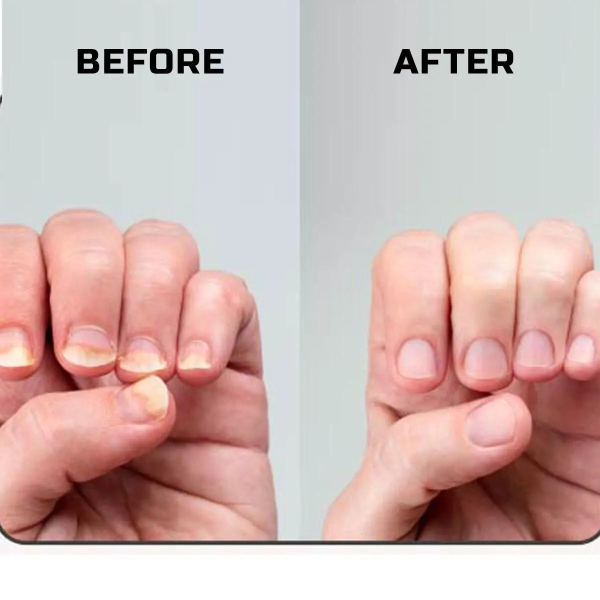 Nail Strength & Growth Oil