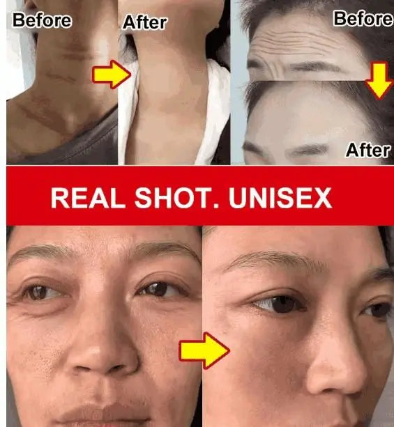 Fuyan Anti-Wrinkle Cream 50g