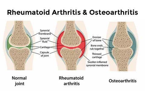 Instant Joint Pain Relief